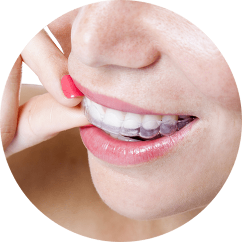 Cosmetic Dentistry - Invisalign