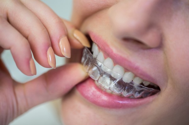 How Much Does Invisalign Cost  Burlington Family Dental Centre